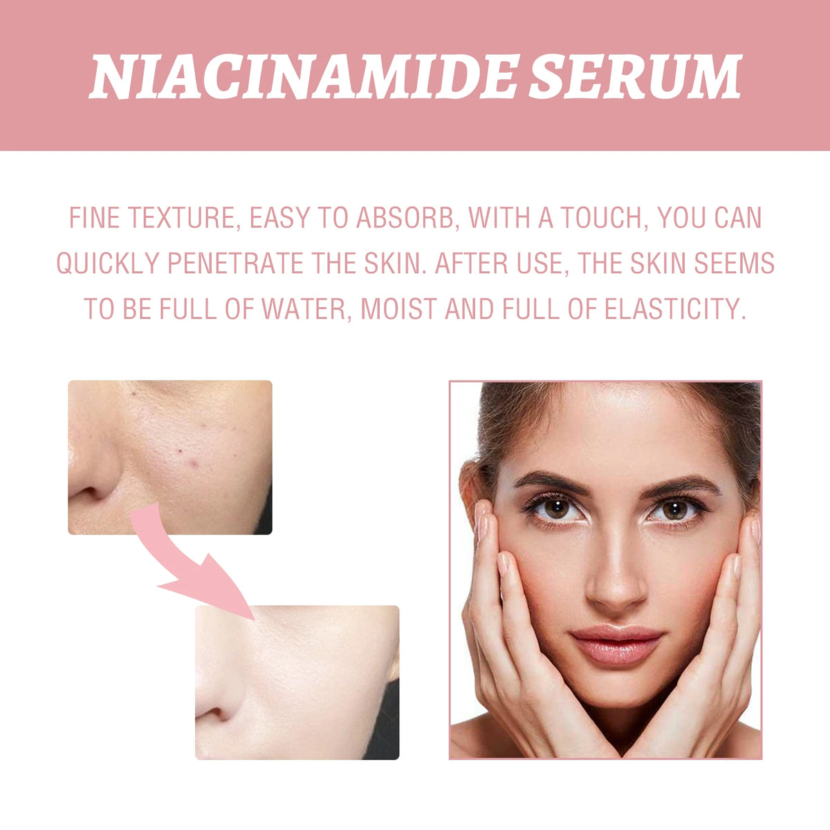 Hoygi Niacinamide Facial Serum With Hyaluronic Acid And Peach Extract
