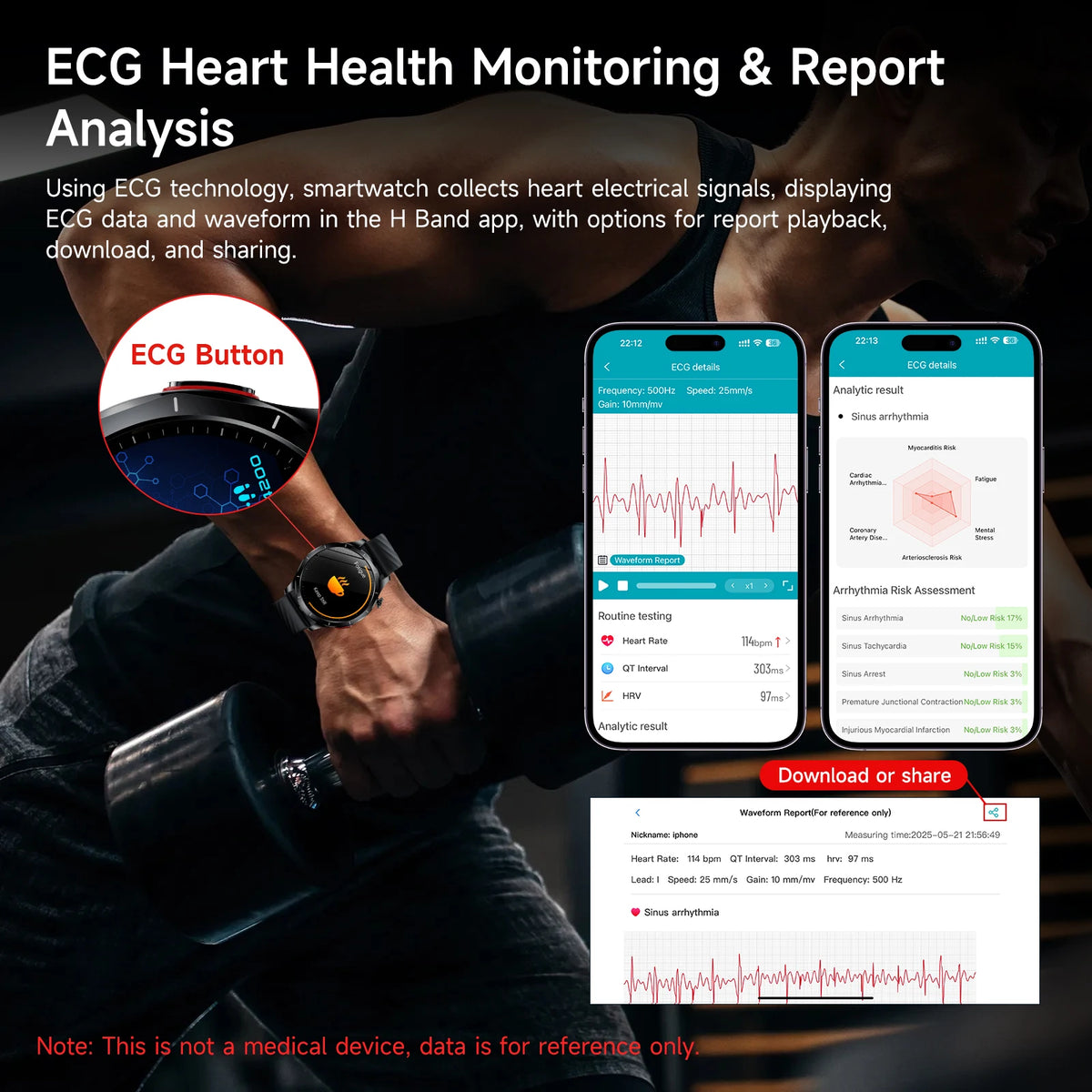 Marsyu Smartwatch With Ecg Ppg Blood Pressure Health Tracker