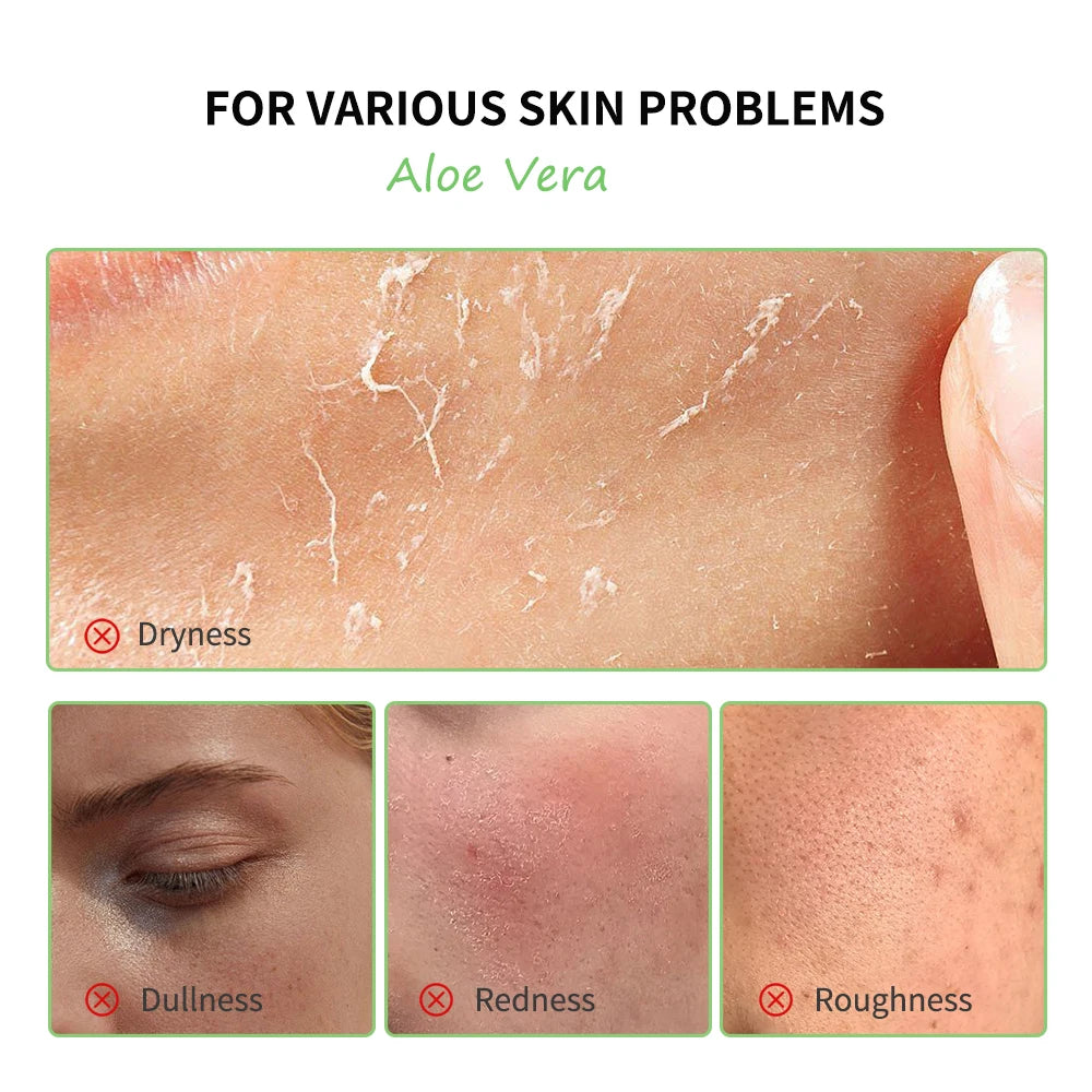 Lakerain Aloe Vera Skincare Set For Deep Moisturizing Facial Care