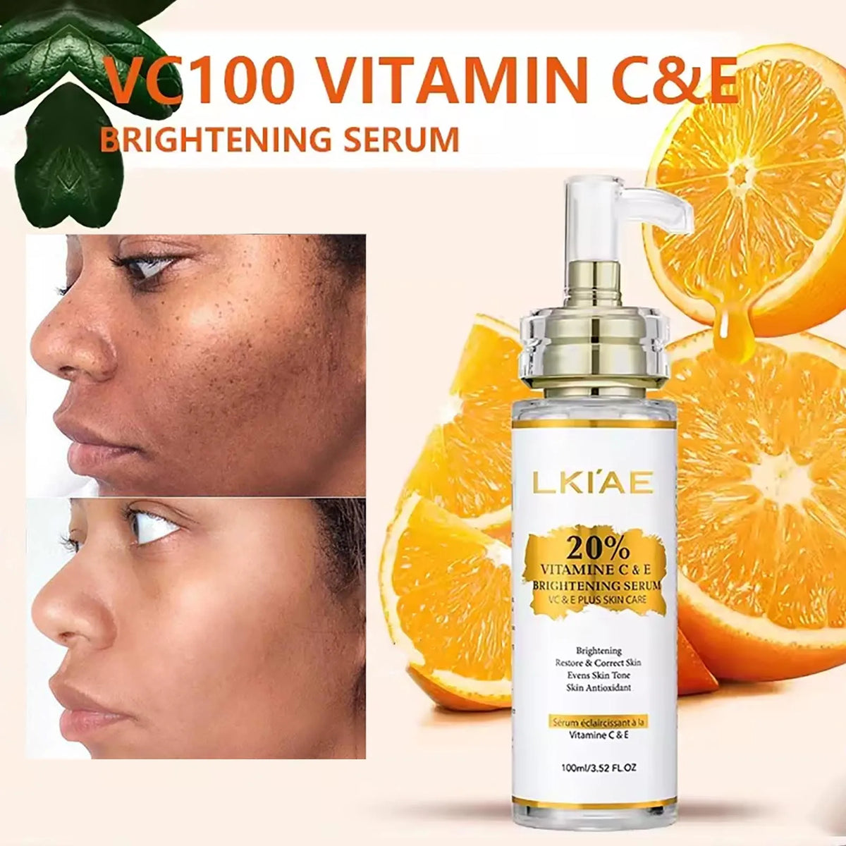 AILKE Vitamin C Brightening Body Cream For Even Skin Tone